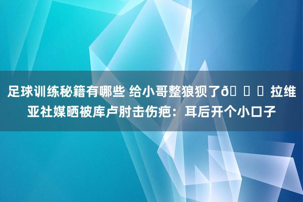 足球训练秘籍有哪些 给小哥整狼狈了😅拉维亚社媒晒被库卢肘击伤疤：耳后开个小口子